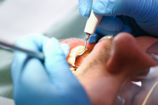 Best Cosmetic Emergency Dentistry in Tamiami, FL
